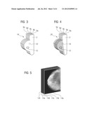 Imaging Method with Improved Display of a Tissue Region, Imaging Device,     and Computer Program Product diagram and image