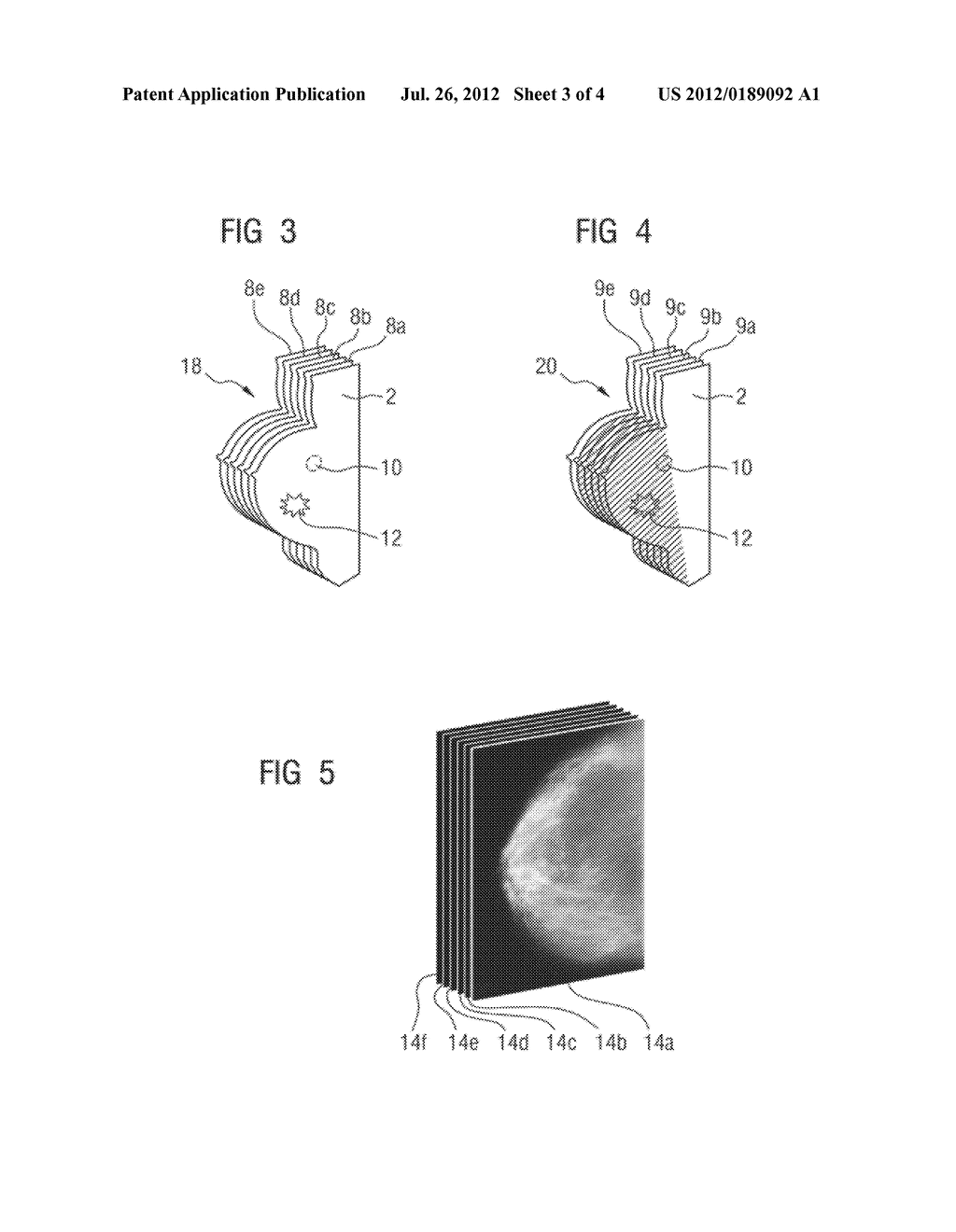 Imaging Method with Improved Display of a Tissue Region, Imaging Device,     and Computer Program Product - diagram, schematic, and image 04