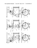 Ring Gantry Radiation Treatment Delivery System With Dynamically     Controllable Inward Extension Of Treatment Head diagram and image