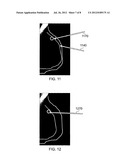 Method and system for analysing tissue from images diagram and image