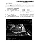 MRI Markers, Delivery and Extraction Systems, and Methods of Manufacture     and Use Thereof diagram and image