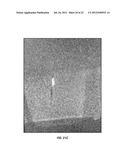 MRI Markers, Delivery and Extraction Systems, and Methods of Manufacture     and Use Thereof diagram and image