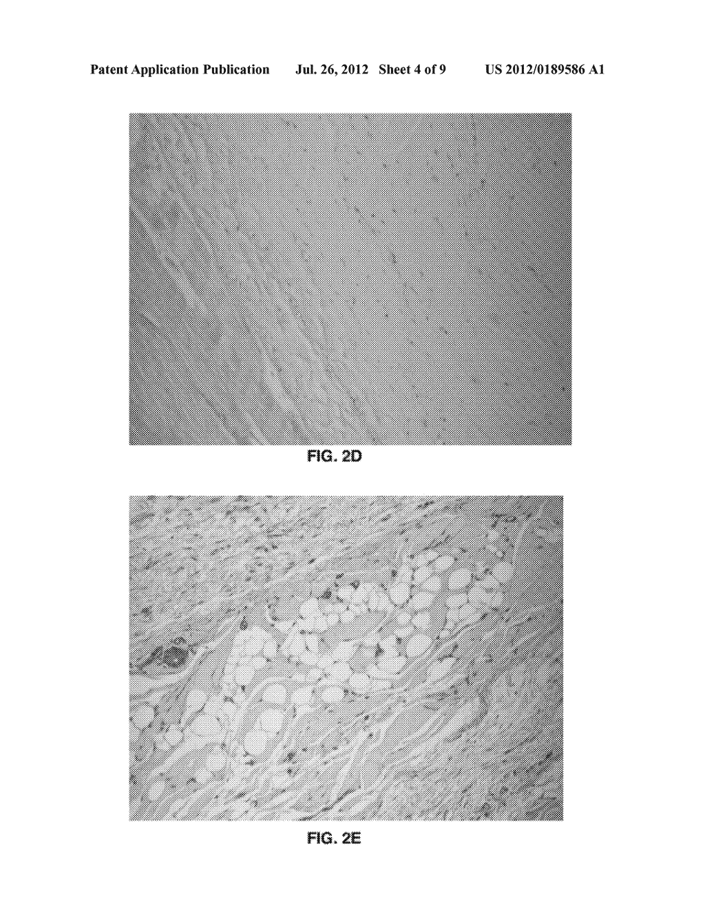 Human Placental Derived Extracellular Matrix and Uses Therof - diagram, schematic, and image 05