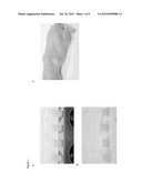 Compositions and Methods for Implantation of Processed Adipose Tissue and     Processed Adipose Tissue Products diagram and image