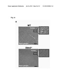 STIM2-MEDIATED CAPACITIVE CALCIUM ENTRY diagram and image