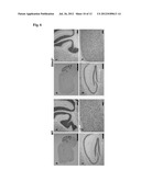 STIM2-MEDIATED CAPACITIVE CALCIUM ENTRY diagram and image