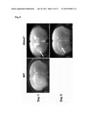 STIM2-MEDIATED CAPACITIVE CALCIUM ENTRY diagram and image