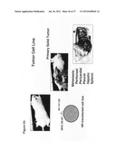 Compositions and methods to treat and control tumors diagram and image