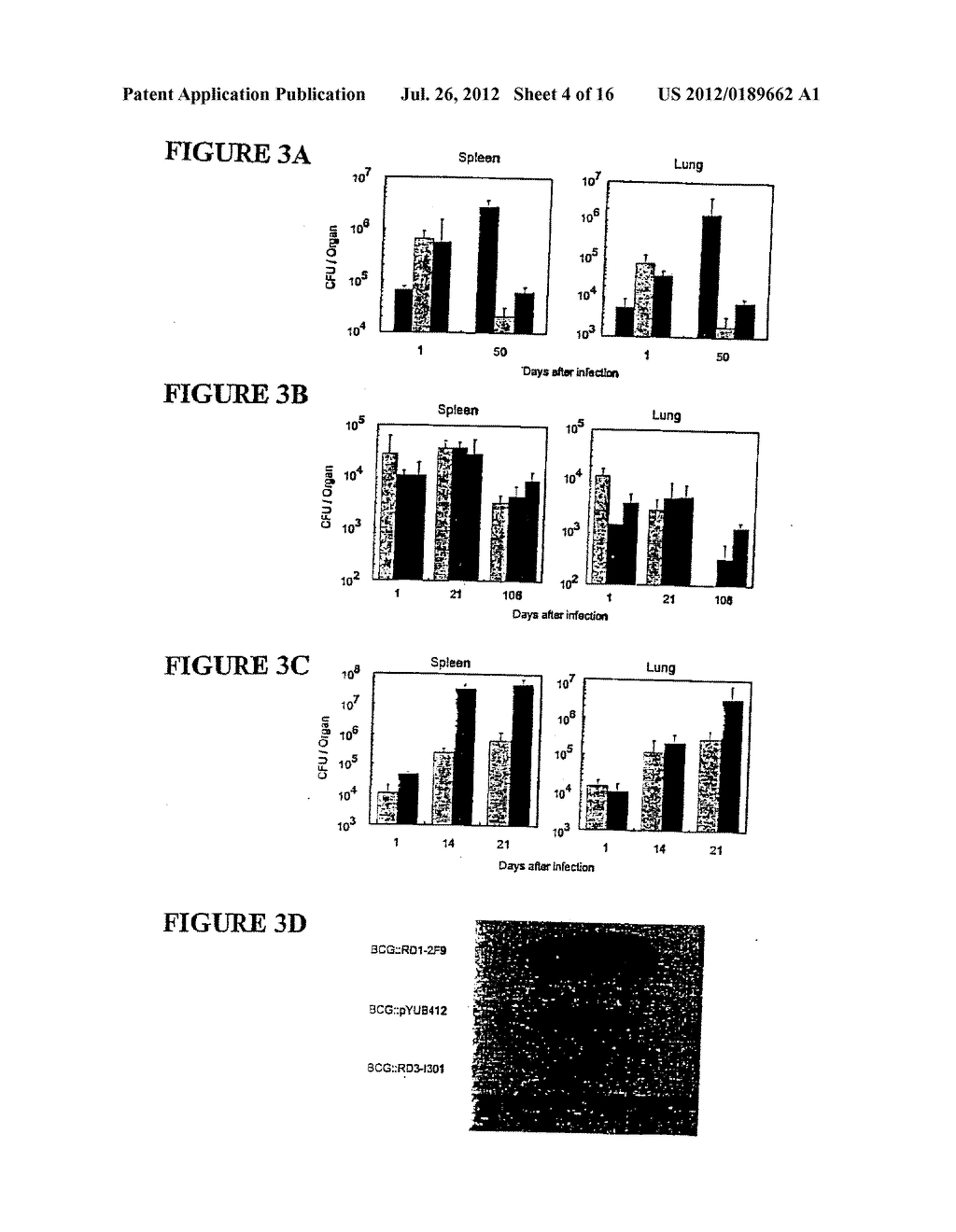 Identification of virulence associated regions RD1 and RD5 leading to     improve vaccine of M. bovis BCG and M. microti - diagram, schematic, and image 05