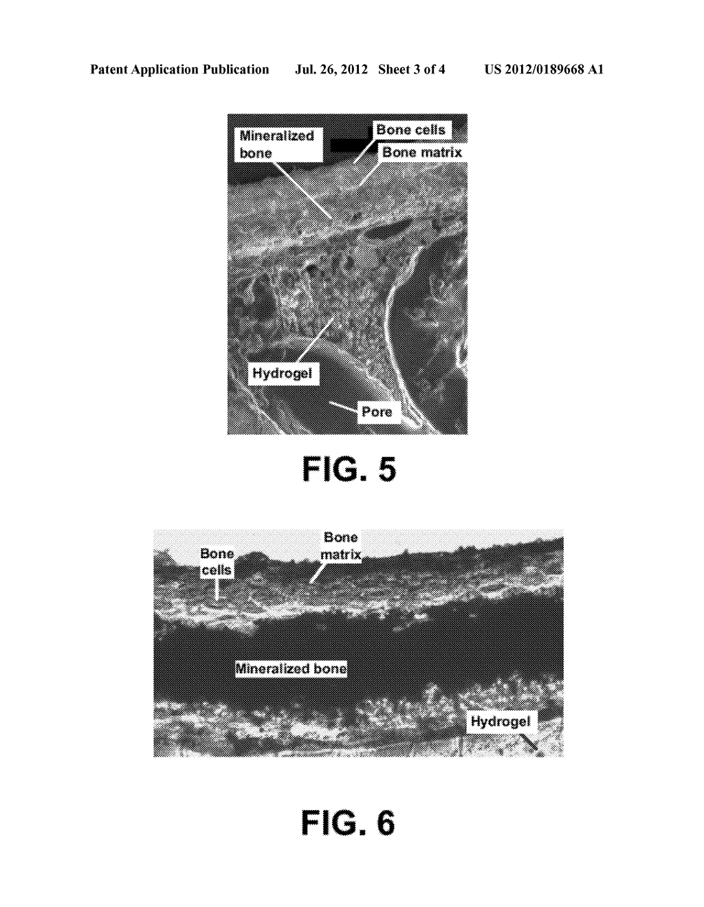 HYDROGEL BIOSCAFFOLD AND COATING FOR BONE AND TOOTH REPAIR - diagram, schematic, and image 04