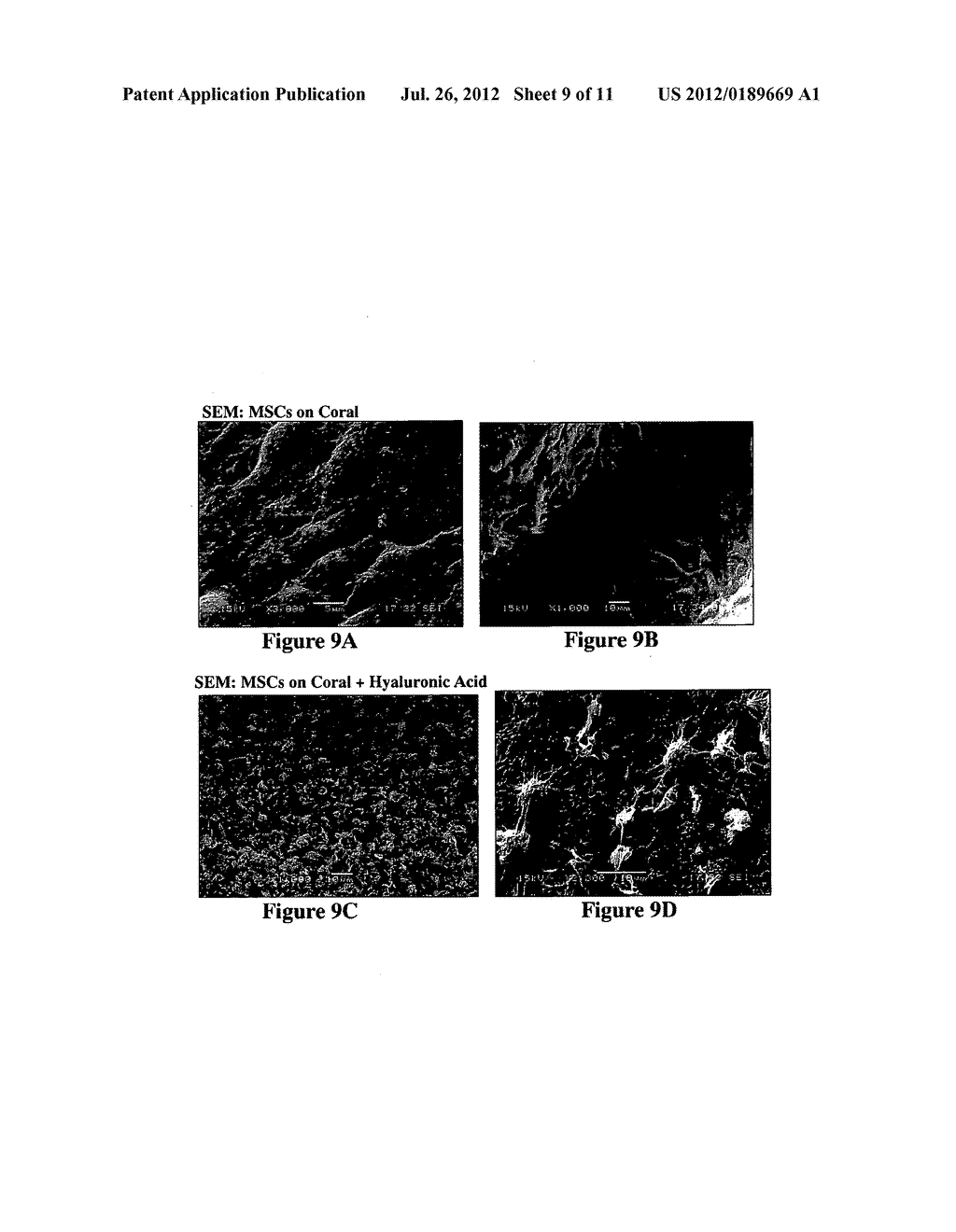 Solid Forms for Tissue Repair - diagram, schematic, and image 10