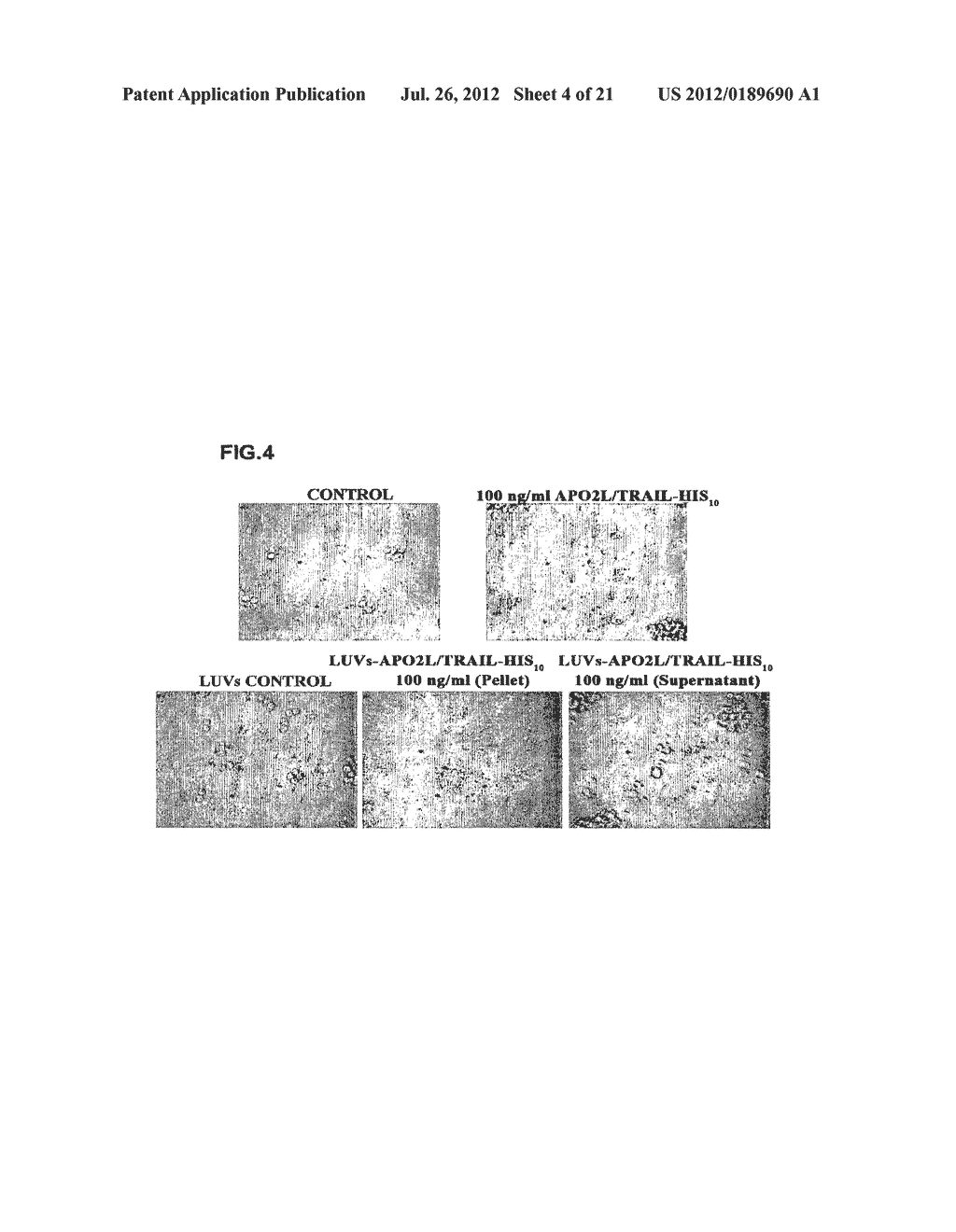 Liposomes covered with the Extracellular Domain of the APO2L/Trail Protein - diagram, schematic, and image 05