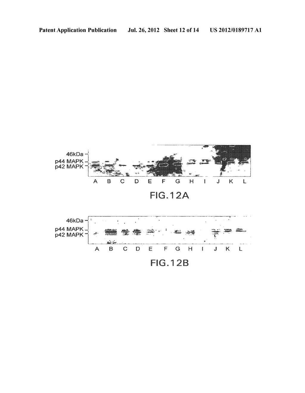 METHOD OF USING BETA-HYDROXY-BETA-METHYLBUTYRATE AND FATTY ACIDS FOR     TREATING DISEASE-ASSOCIATED WASTING - diagram, schematic, and image 13