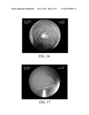 FLEXIBLE AND RIGID ENDOSCOPIC TRAINING DEVICE (FRED) diagram and image