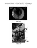 FLEXIBLE AND RIGID ENDOSCOPIC TRAINING DEVICE (FRED) diagram and image