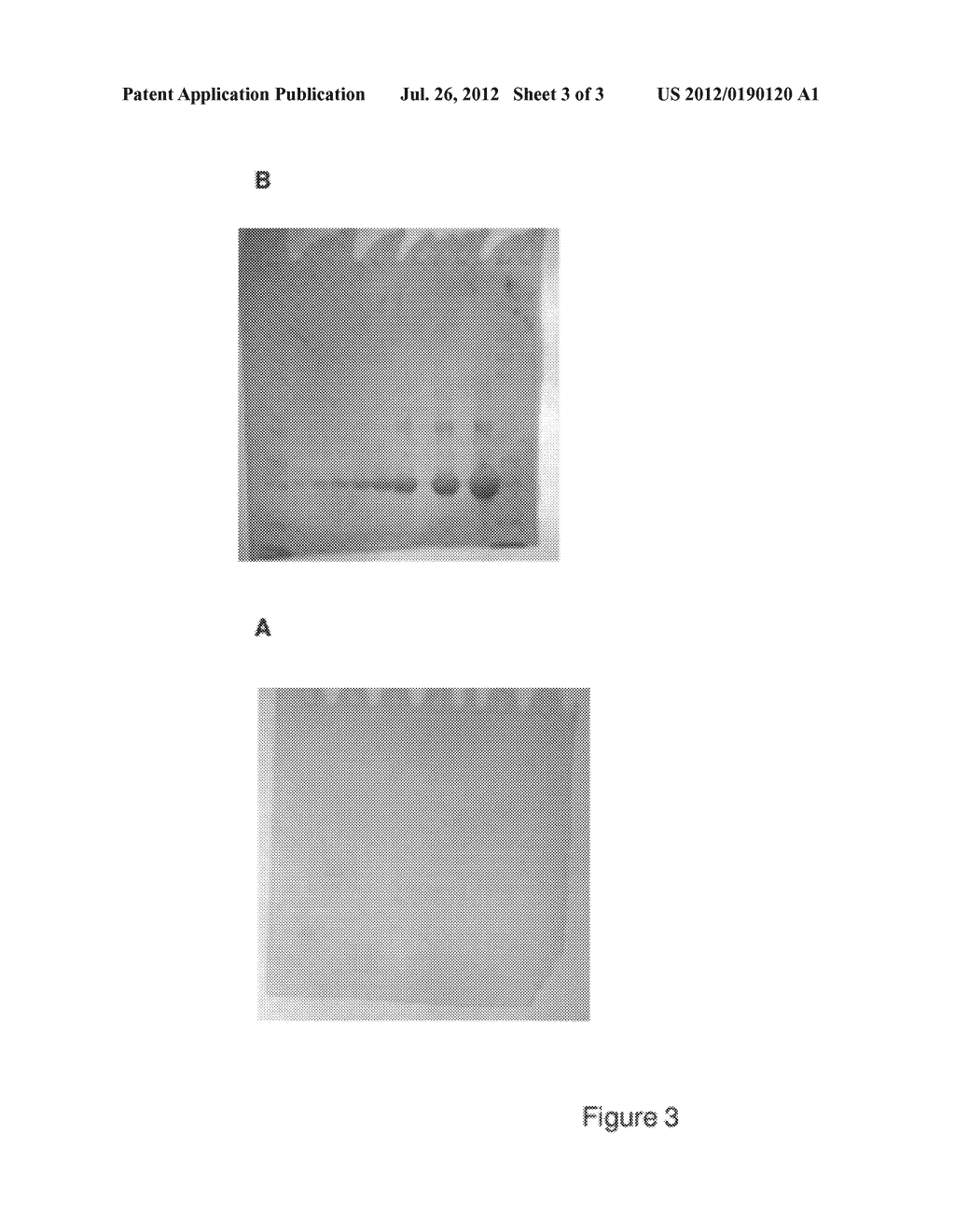 PROTEIN DETECTION REAGENTS AND METHODS WITH DYES AND DEXTRINS - diagram, schematic, and image 04