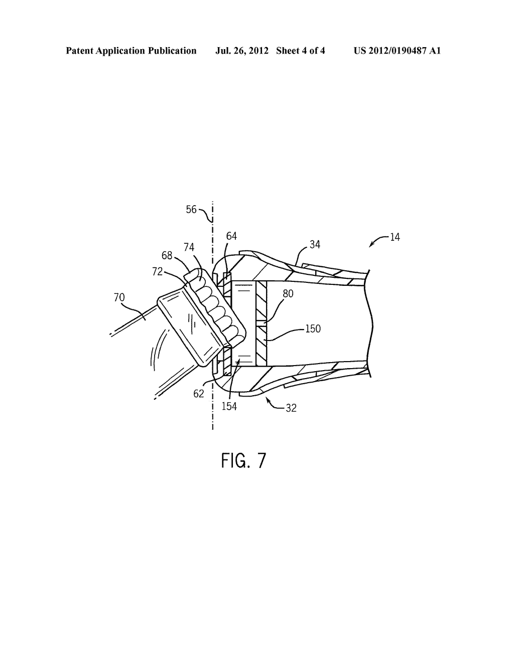 SPORTS RACQUET FOR IMPACTING A BALL AND FACILITATING THE OPENING OF A CAP     ON A BOTTLE - diagram, schematic, and image 05