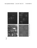 LIGHT-RECEIVING CHANNEL RHODOPSIN HAVING IMPROVED EXPRESSION EFFICIENCY diagram and image