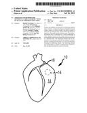 APPARATUS AND METHODS FOR SUPPORTING CARDIAC ISCHEMIC TISSUE BY MEANS OF     EMBEDDED STRUCTURES diagram and image