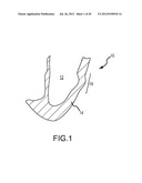 APPARATUS AND METHODS FOR SUPPORTING CARDIAC ISCHEMIC TISSUE BY MEANS OF     EMBEDDED STRUCTURES diagram and image