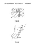 APPARATUS AND METHODS FOR SUPPORTING CARDIAC ISCHEMIC TISSUE BY MEANS OF     EMBEDDED STRUCTURES diagram and image