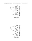 APPARATUS AND METHODS FOR SUPPORTING CARDIAC ISCHEMIC TISSUE BY MEANS OF     EMBEDDED STRUCTURES diagram and image