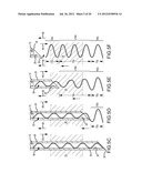 APPARATUS AND METHODS FOR SUPPORTING CARDIAC ISCHEMIC TISSUE BY MEANS OF     EMBEDDED STRUCTURES diagram and image