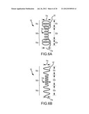 APPARATUS AND METHODS FOR SUPPORTING CARDIAC ISCHEMIC TISSUE BY MEANS OF     EMBEDDED STRUCTURES diagram and image