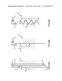 APPARATUS AND METHODS FOR SUPPORTING CARDIAC ISCHEMIC TISSUE BY MEANS OF     EMBEDDED STRUCTURES diagram and image