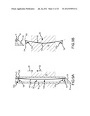 APPARATUS AND METHODS FOR SUPPORTING CARDIAC ISCHEMIC TISSUE BY MEANS OF     EMBEDDED STRUCTURES diagram and image