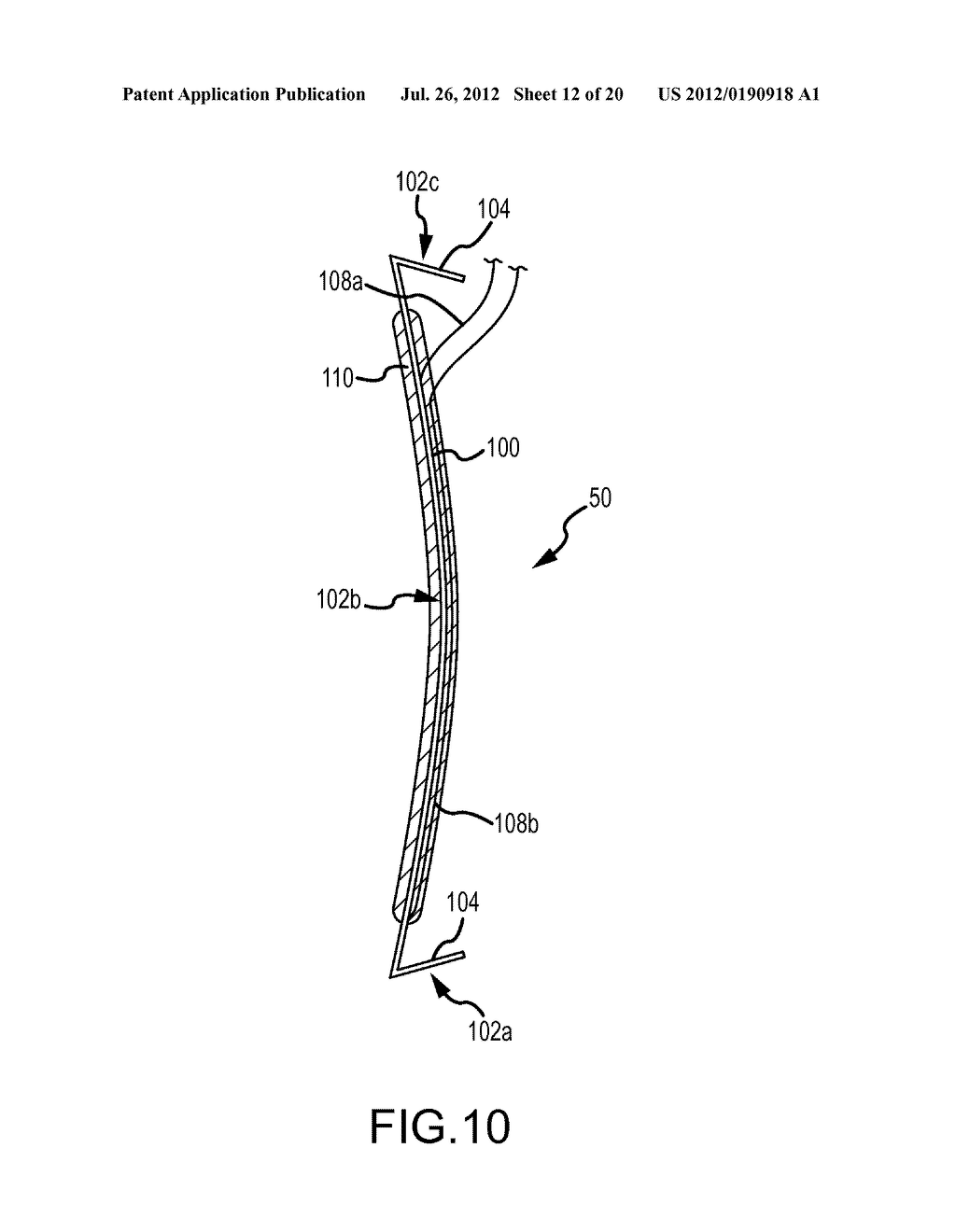 APPARATUS AND METHODS FOR SUPPORTING CARDIAC ISCHEMIC TISSUE BY MEANS OF     EMBEDDED STRUCTURES - diagram, schematic, and image 13