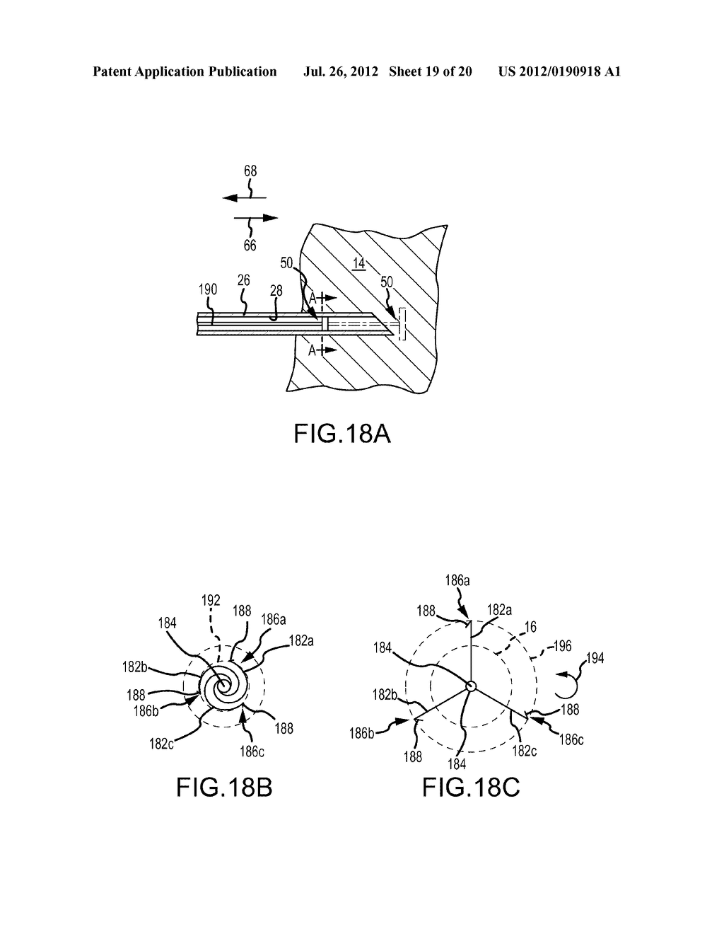 APPARATUS AND METHODS FOR SUPPORTING CARDIAC ISCHEMIC TISSUE BY MEANS OF     EMBEDDED STRUCTURES - diagram, schematic, and image 20