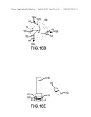 APPARATUS AND METHODS FOR SUPPORTING CARDIAC ISCHEMIC TISSUE BY MEANS OF     EMBEDDED STRUCTURES diagram and image