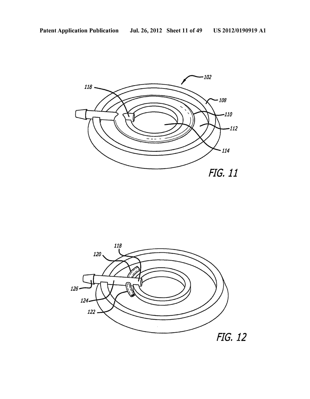 ASSEMBLY AND METHOD FOR AUTOMATICALLY CONTROLLING PRESSURE FOR A GASTRIC     BAND - diagram, schematic, and image 12