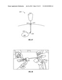 ARTICULATE AND SWAPABLE ENDOSCOPE FOR A SURGICAL ROBOT diagram and image