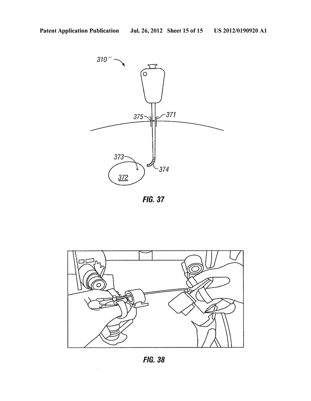 ARTICULATE AND SWAPABLE ENDOSCOPE FOR A SURGICAL ROBOT - diagram, schematic, and image 16