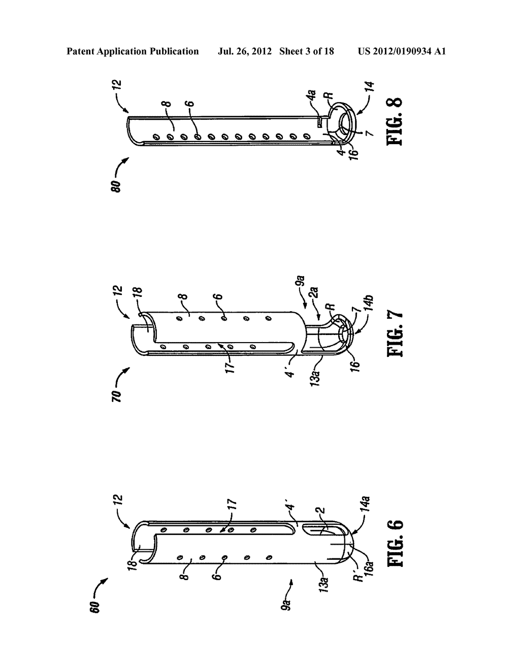 MINIMALLY INVASIVE RETRACTOR AND POSTED SCREW - diagram, schematic, and image 04