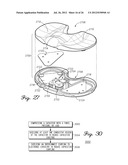 SENSORED PROSTHETIC COMPONENT AND METHOD diagram and image