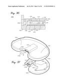 SENSORED PROSTHETIC COMPONENT AND METHOD diagram and image