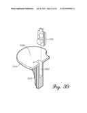 SENSORED PROSTHETIC COMPONENT AND METHOD diagram and image