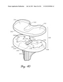 SENSORED PROSTHETIC COMPONENT AND METHOD diagram and image