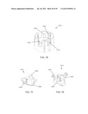 Medical Device Inserters and Processes of Inserting and Using Medical     Devices diagram and image