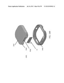 Medical Device Inserters and Processes of Inserting and Using Medical     Devices diagram and image