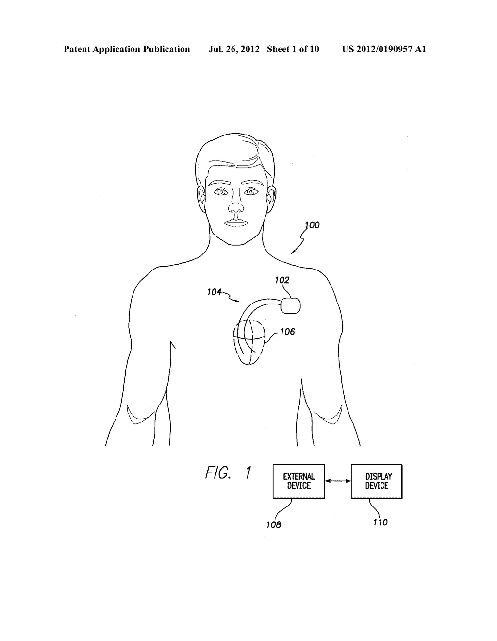 SYSTEM AND METHOD FOR MONITORING CARDIAC DISEASE - diagram, schematic, and image 02