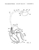 SYSTEM AND METHOD FOR MONITORING CARDIAC DISEASE diagram and image