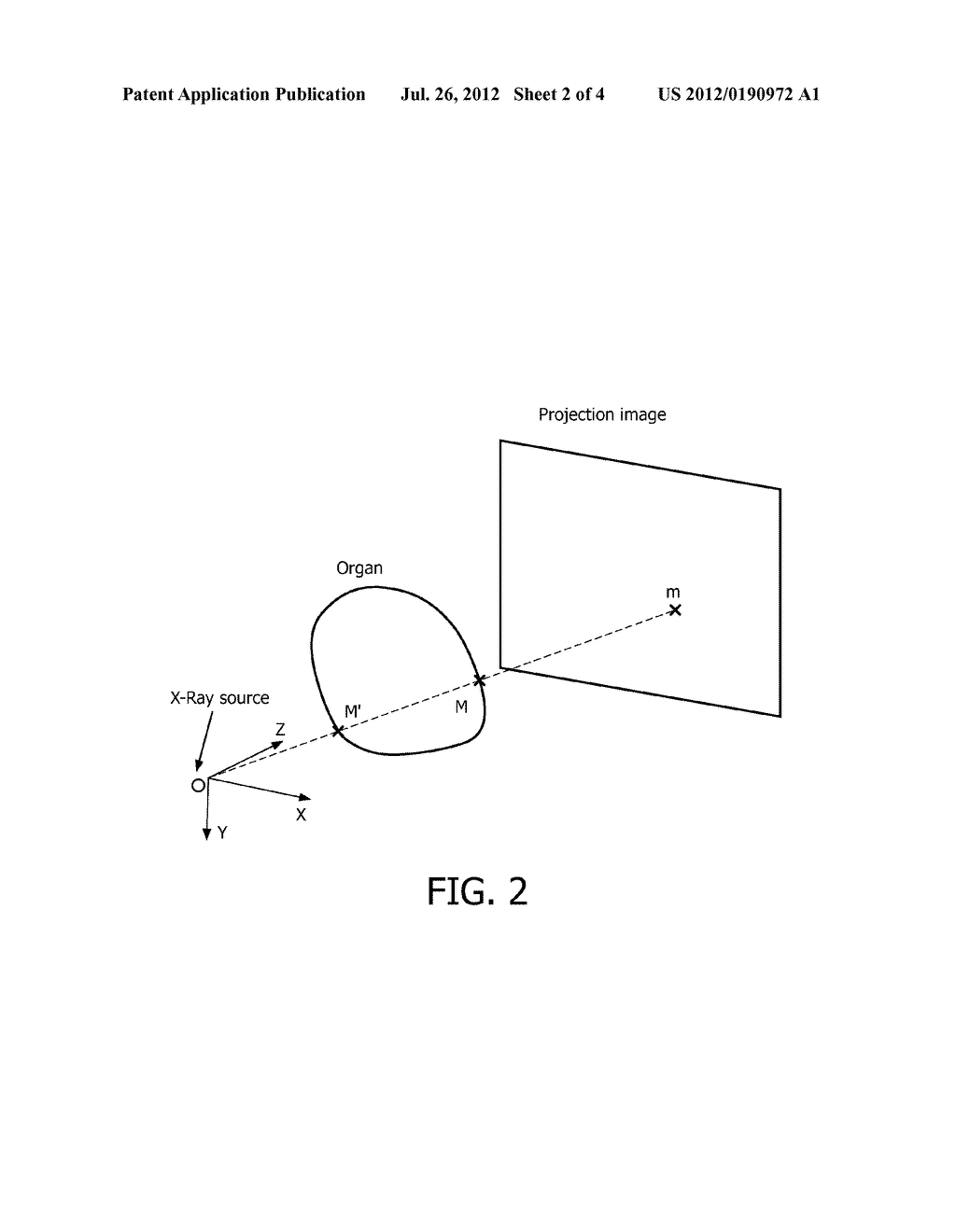 DEPTH DISAMBIGUATION OF INTERVENTIONAL INSTRUMENTS FROM A SINGLE X-RAY     PROJECTION IMAGE AND ITS CALIBRATION - diagram, schematic, and image 03