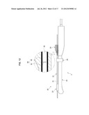 TREATMENT DEVICE diagram and image