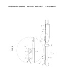 TREATMENT DEVICE diagram and image