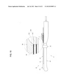 TREATMENT DEVICE diagram and image