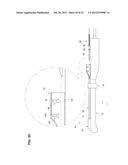 TREATMENT DEVICE diagram and image